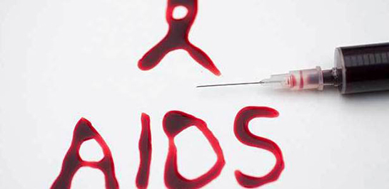 Aids Nedir